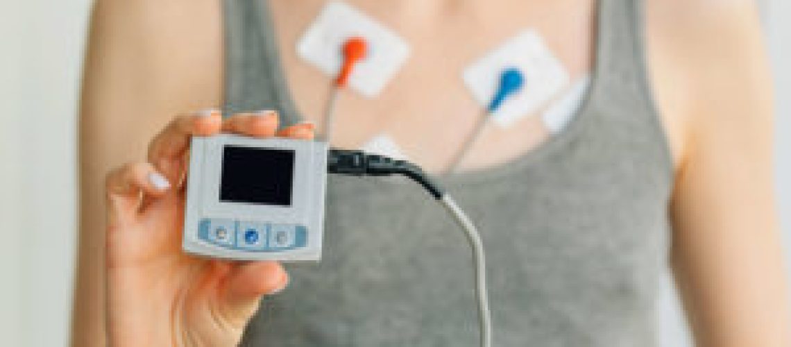 exame-holter-o-que-e-e-para-que-serve-300x200